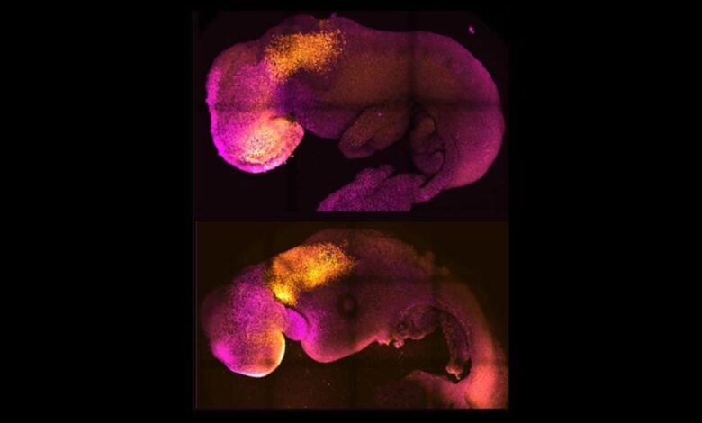 Photo of Embrione sintetico con cervello e cuore pulsante PRESTO EMBRIONI UMANI SINTETICI